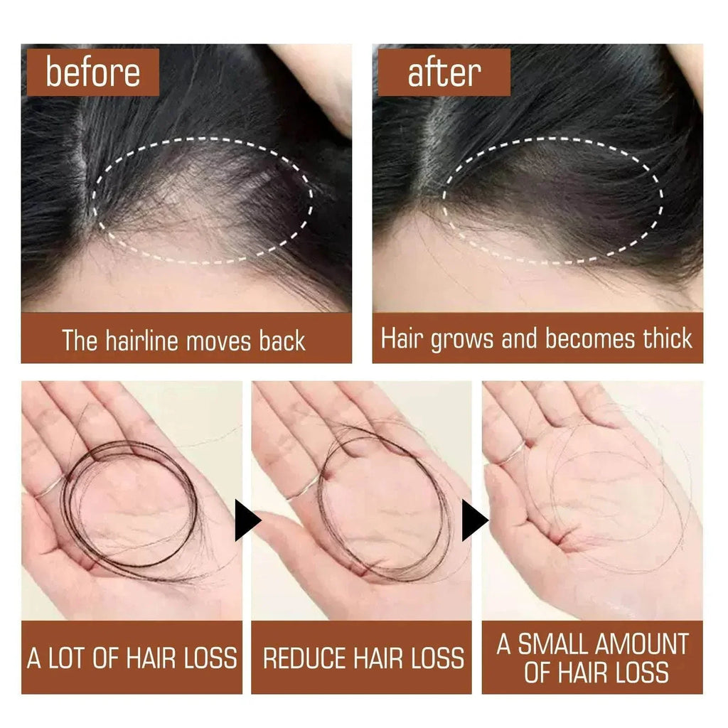 Batana Oil Hair Mask | Smoothing & Anti-Hair Loss - ZA-Zola